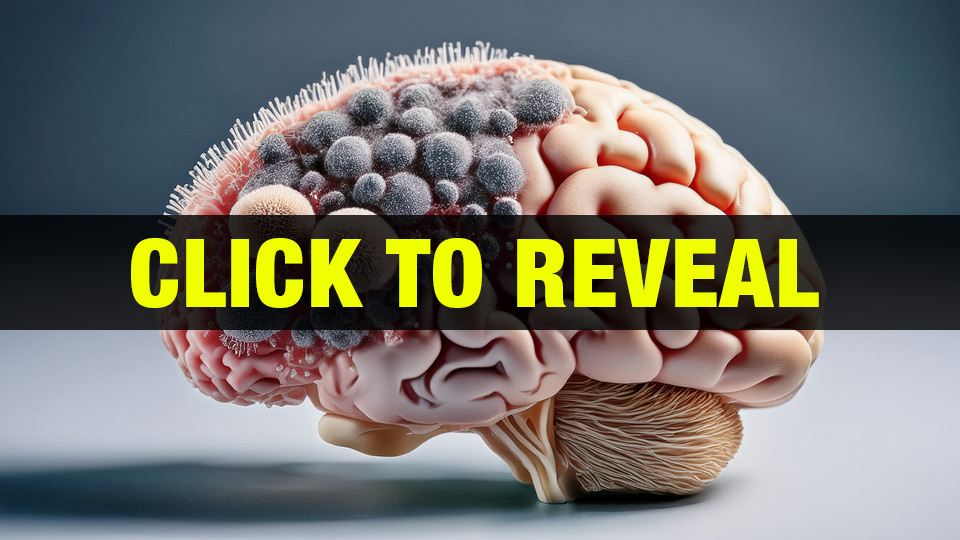 brain